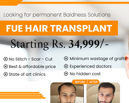 Hair Transplant in Indore - FUE Clinics & Cost | Keratin Strings