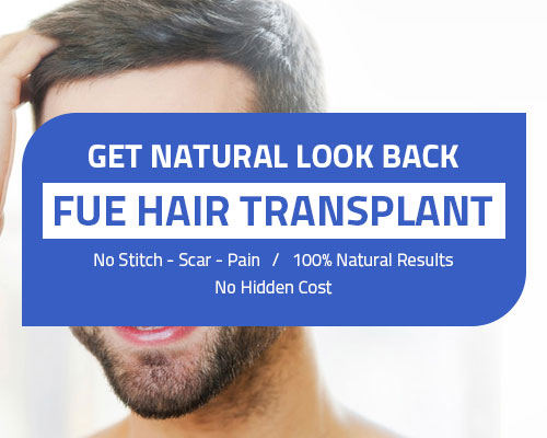 Hair Transplant in Indore - FUE Clinics & Cost | Keratin Strings